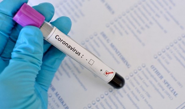 В Україні вже зафіксовано 113 випадків інфікування коронавірусом