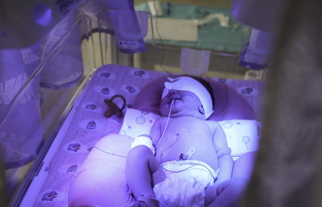 Маленькі янголи: Мукачівські лікарі щодня рятують життя недоношених дітей (ФОТО, ВІДЕО)