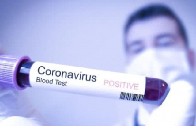В Україні вже 14 випадків захворювання на коронавірус: 2 з них смертельні